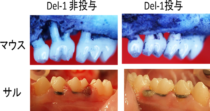 図2　Del-1による歯周病治療法の可能性の検索