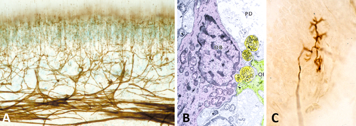 A: ヒトの歯髄神経（p75-NGFRの免疫染色）， B: 神経終末， C: 歯根膜のルフィニ神経終末